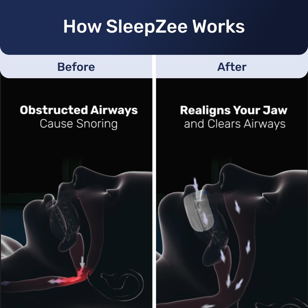 SleepZee image