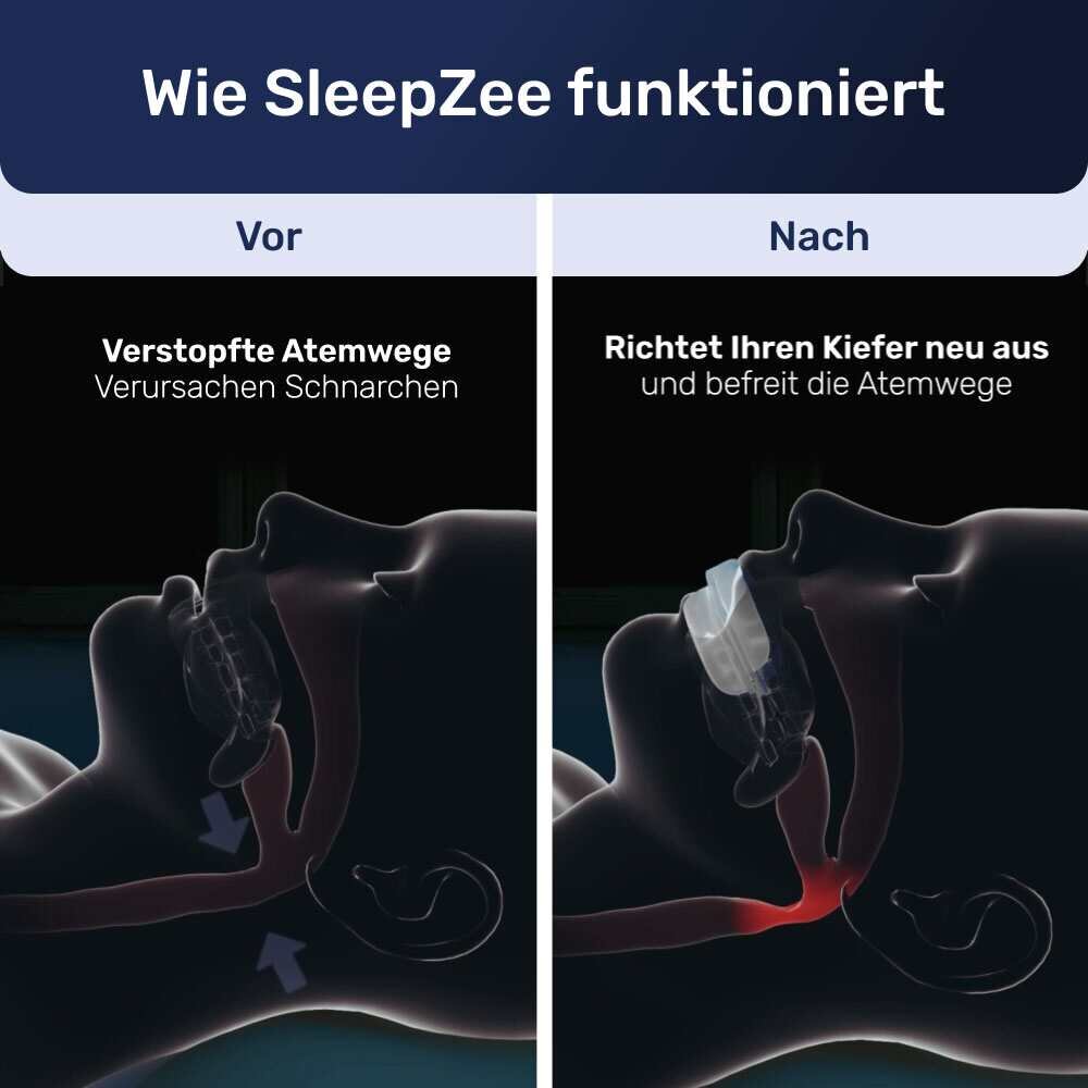SleepZee image